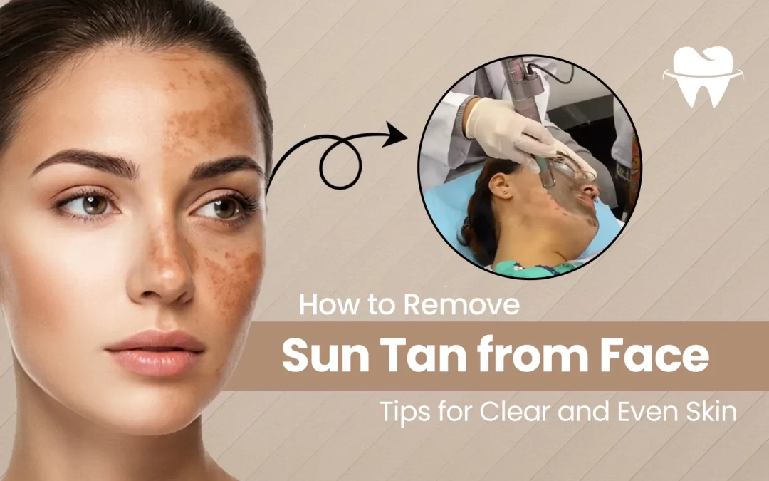 How to Remove Sun Tan from Face: Tips for Clear and Even Skin