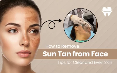 How to Remove Sun Tan from Face: Tips for Clear and Even Skin