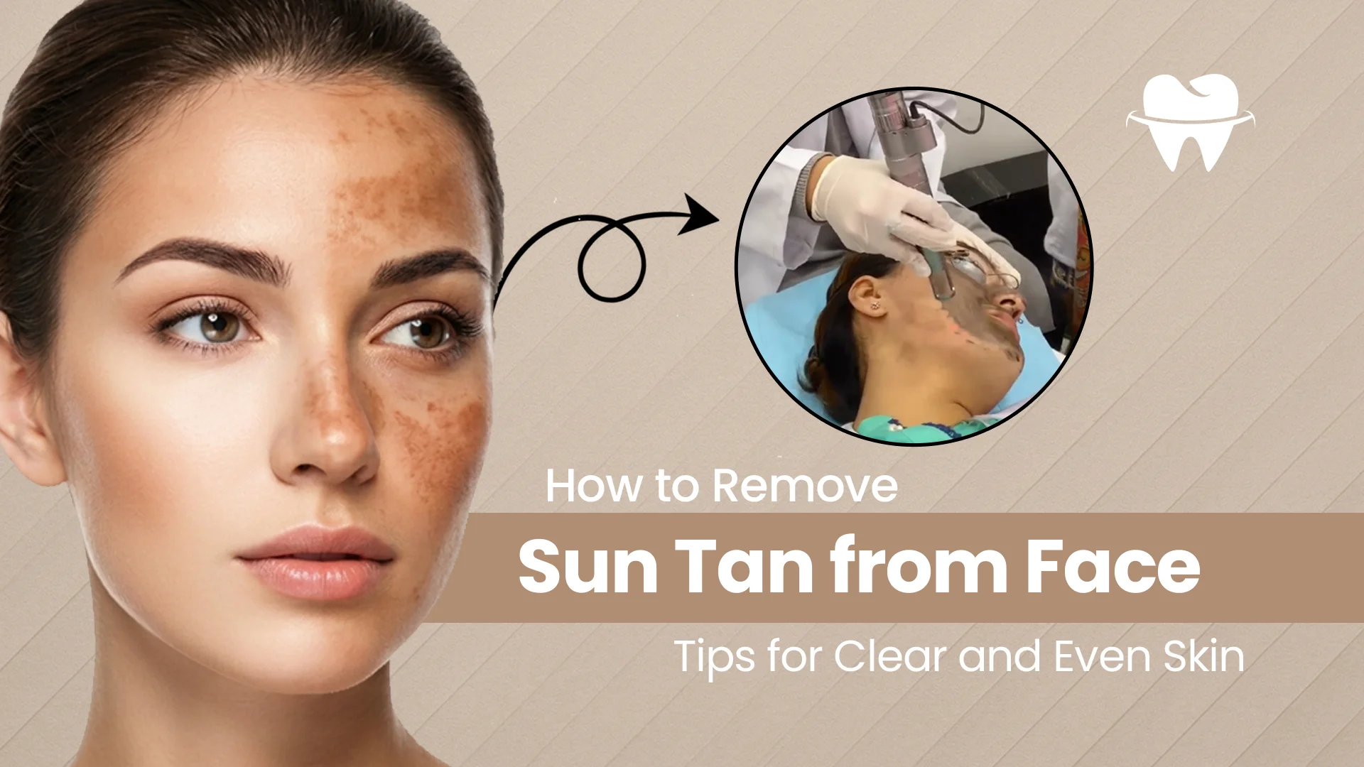 How to Remove Sun Tan from Face