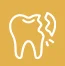 Loose-or-Weak-Teeth