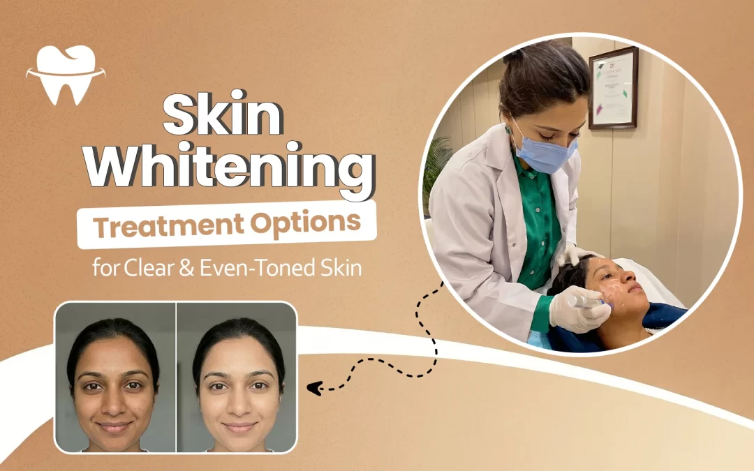 Skin Whitening Treatment Options for Clear and Even-Toned Skin