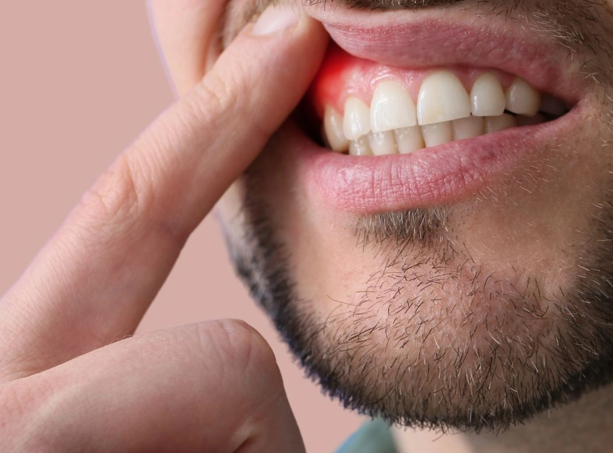 When Should You See a Periodontal Dentist