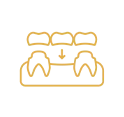 Dental Bridge