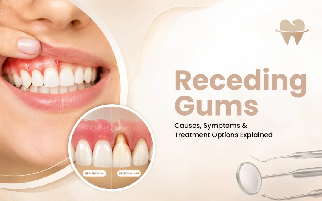 Receding Gums: Causes, Symptoms & Treatment Options Explained