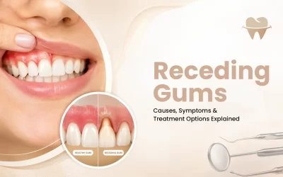 Receding Gums: Causes, Symptoms & Treatment Options Explained