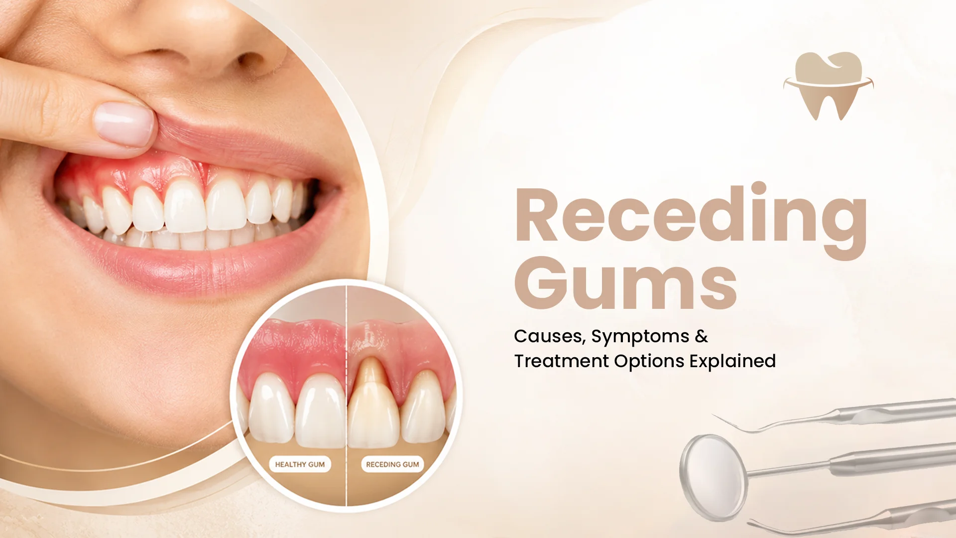 Receding Gums: Causes, Symptoms and Treatment Receding Gums: Causes, Symptoms and Treatment