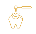 Teeth Fillings