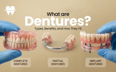 What Are Dentures? Types, Benefits, and How They Fit