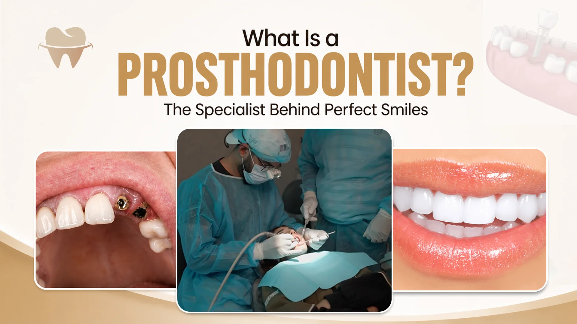 What Is a Prosthodontist What Is a Prosthodontist