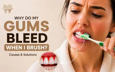 Why Do My Gums Bleed When I Brush? Causes & Solutions for Pakistan