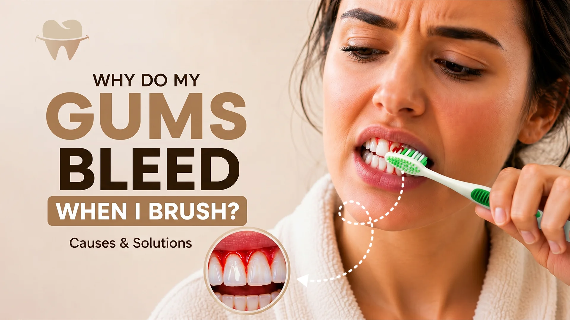 Why Do My Gums Bleed When I Brush Why Do My Gums Bleed When I Brush