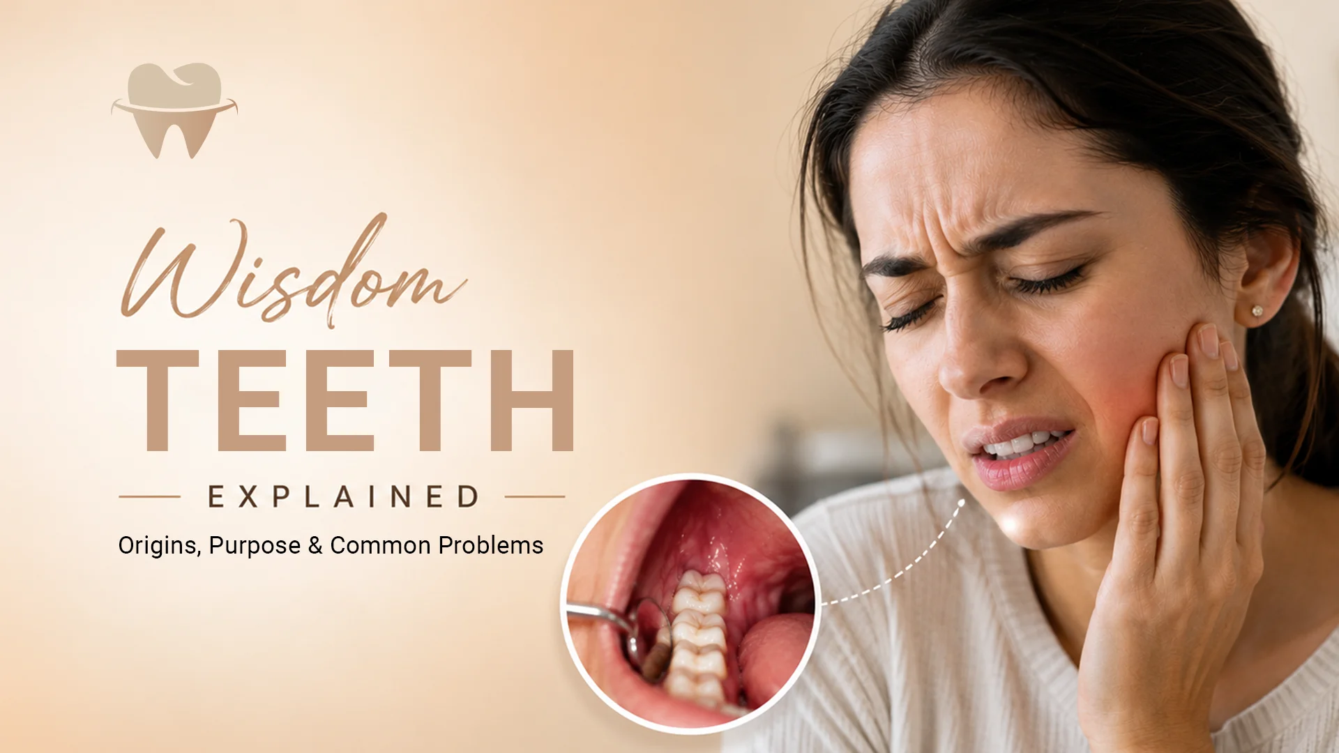 Wisdom Teeth Explained – Origins, Purpose & Common Problems Wisdom Teeth Explained - Origins, Purpose & Common Problems