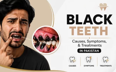 Black Teeth: Causes, Symptoms & Treatments in Pakistan