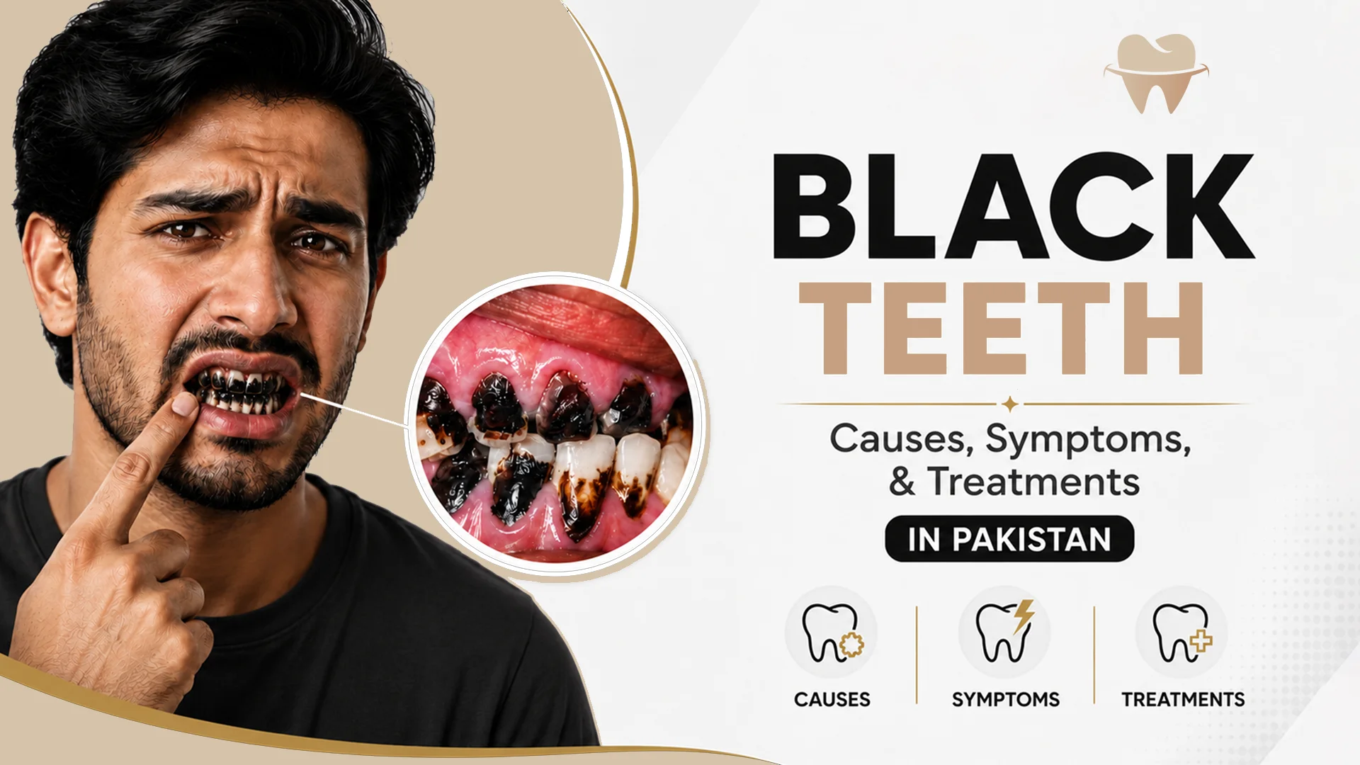 Black Teeth Black Teeth