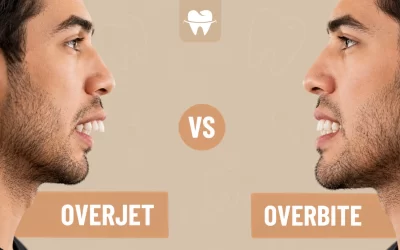 Overjet vs Overbite Teeth: Key Differences, Causes and Treatment