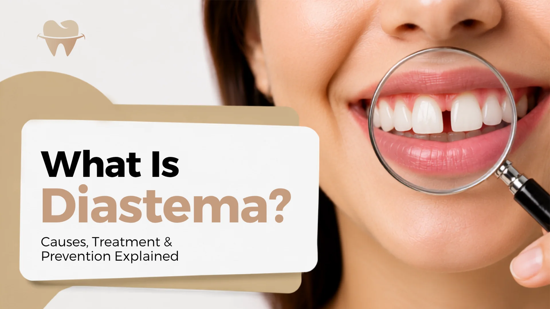 What Is Diastema