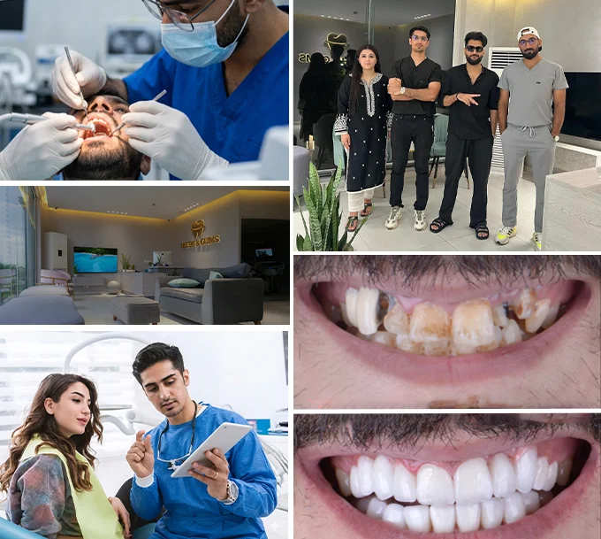 Why-Choose-Teeth-and-Gums-for-Dental-Care-in-Lahore Why-Choose-Teeth-and-Gums-for-Dental-Care-in-Lahore