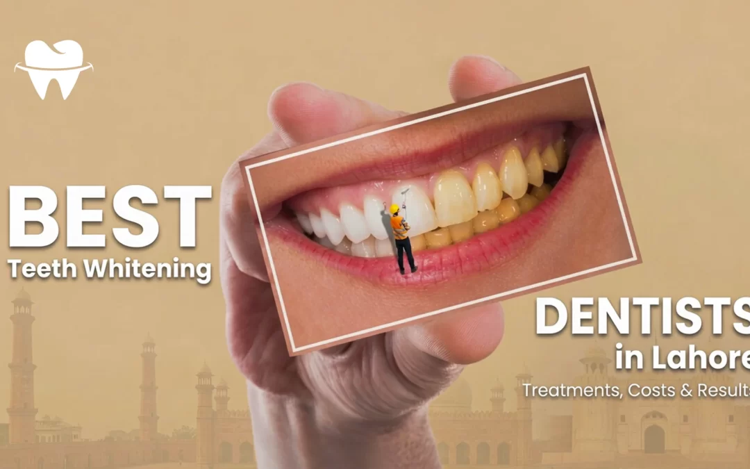 10 Best Teeth Whitening Dentists in Lahore: Treatments, Costs & Results