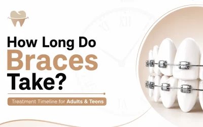 How Long Do Braces Take? Treatment Timeline for Adults & Teens