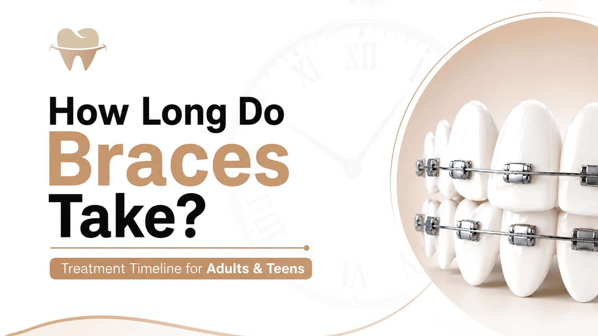 how-long-do-braces-take how-long-do-braces-take