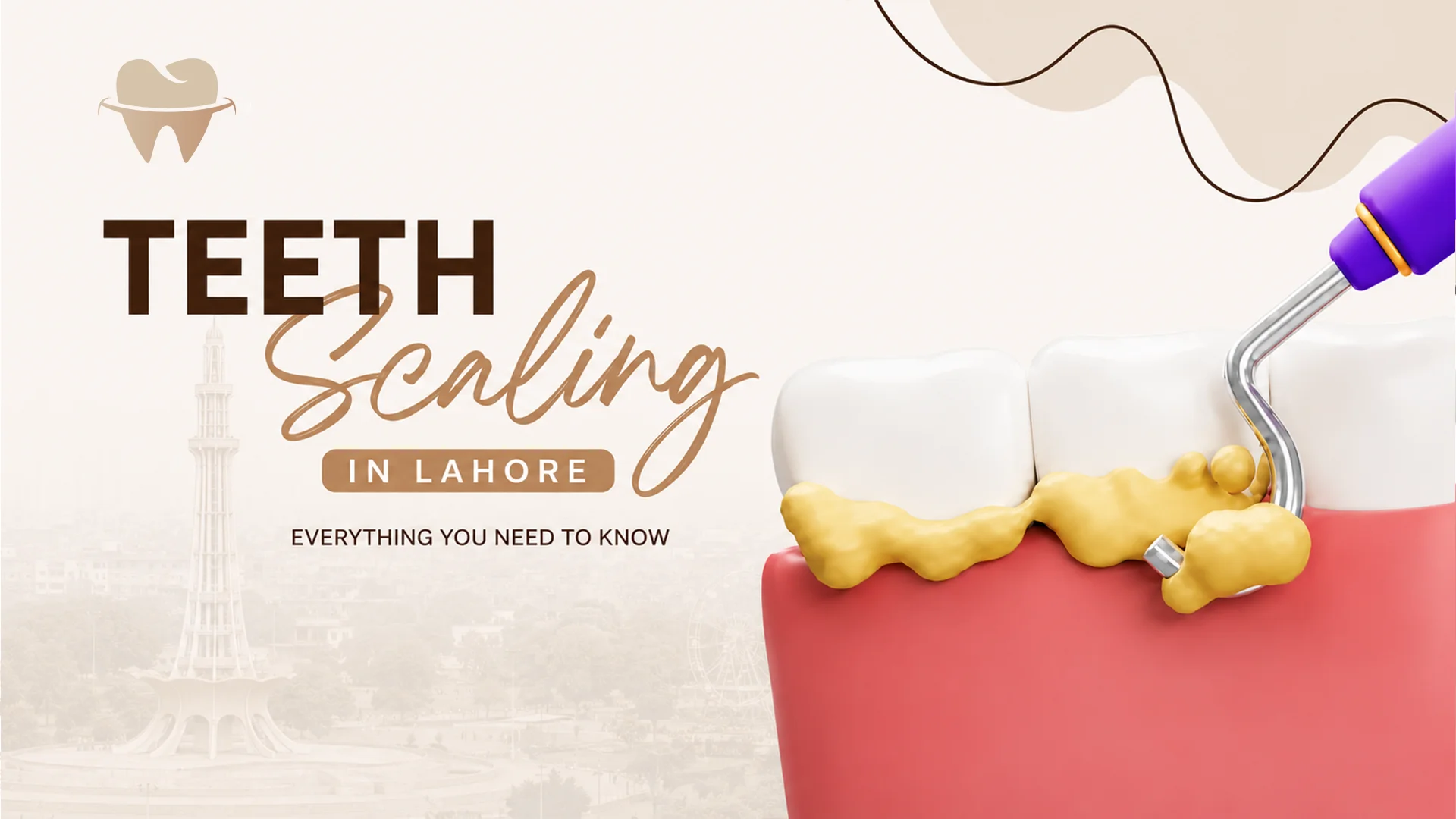 Teeth Scaling in Lahore
