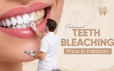Professional Teeth Bleaching Price in Pakistan: Complete Cost Guide