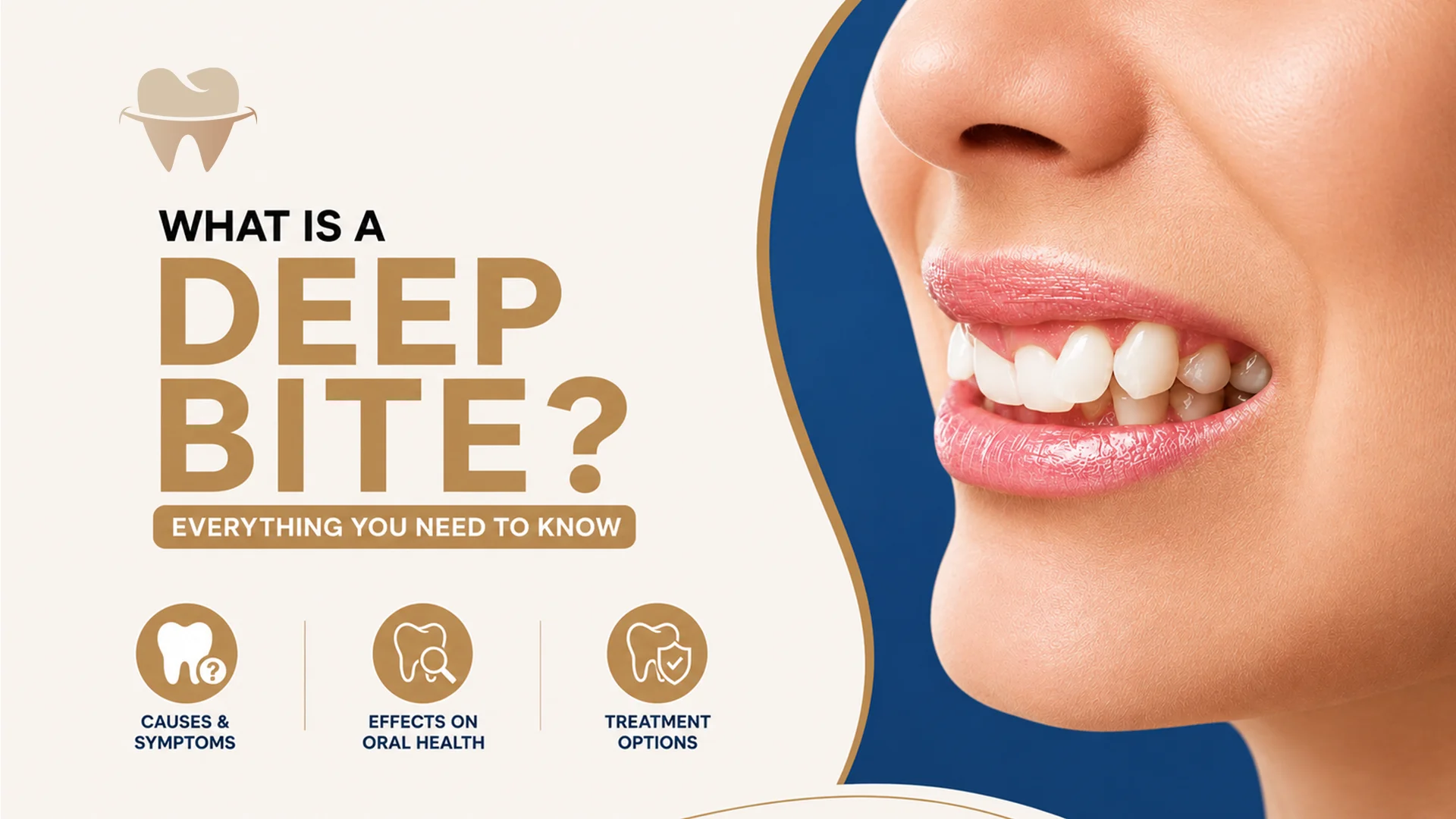 What Is a Deep Bite What Is a Deep Bite