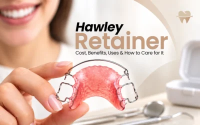Hawley Retainer: Cost, Benefits, Uses and How to Care for It