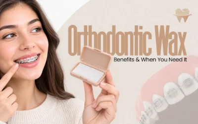 Orthodontic Wax: How to Use It, Benefits and When You Need It