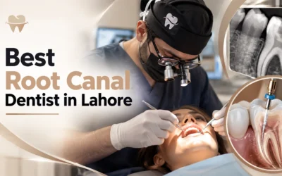 Best Root Canal Dentists in Lahore – Treatment & Patient Guide
