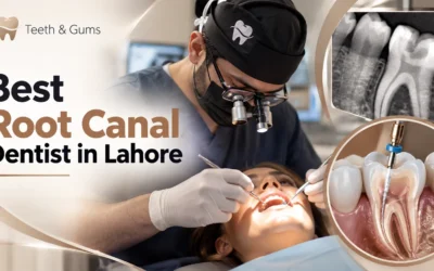 Best Root Canal Dentists in Lahore – Treatment & Patient Guide