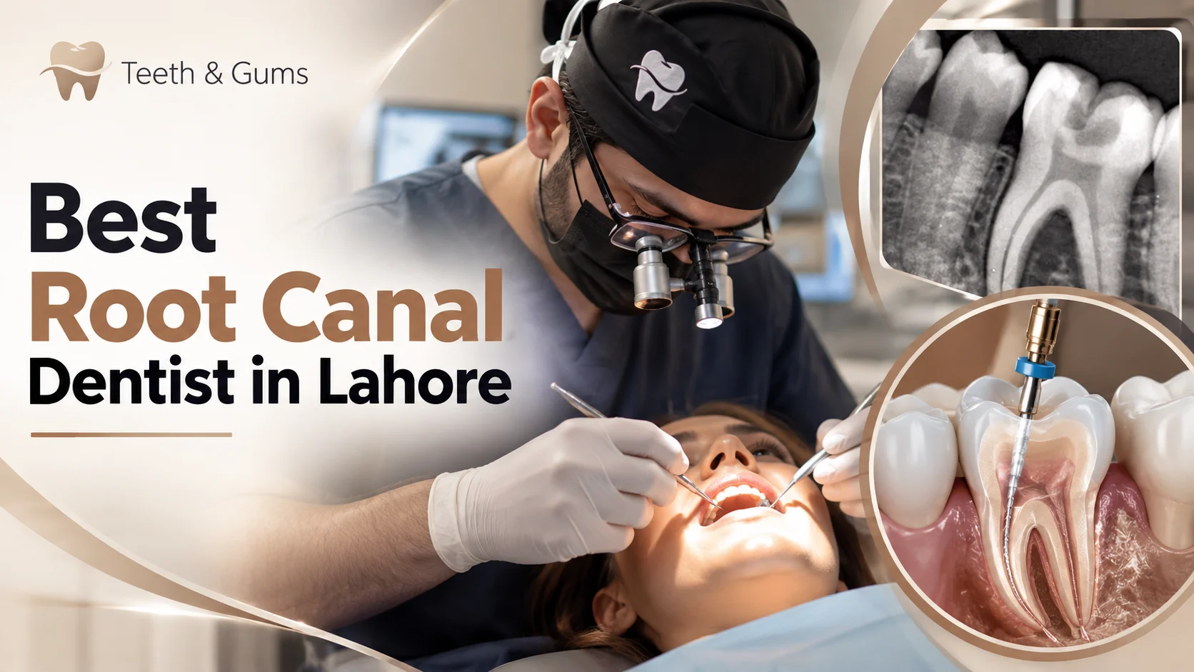 Best Root Canal in Lahore