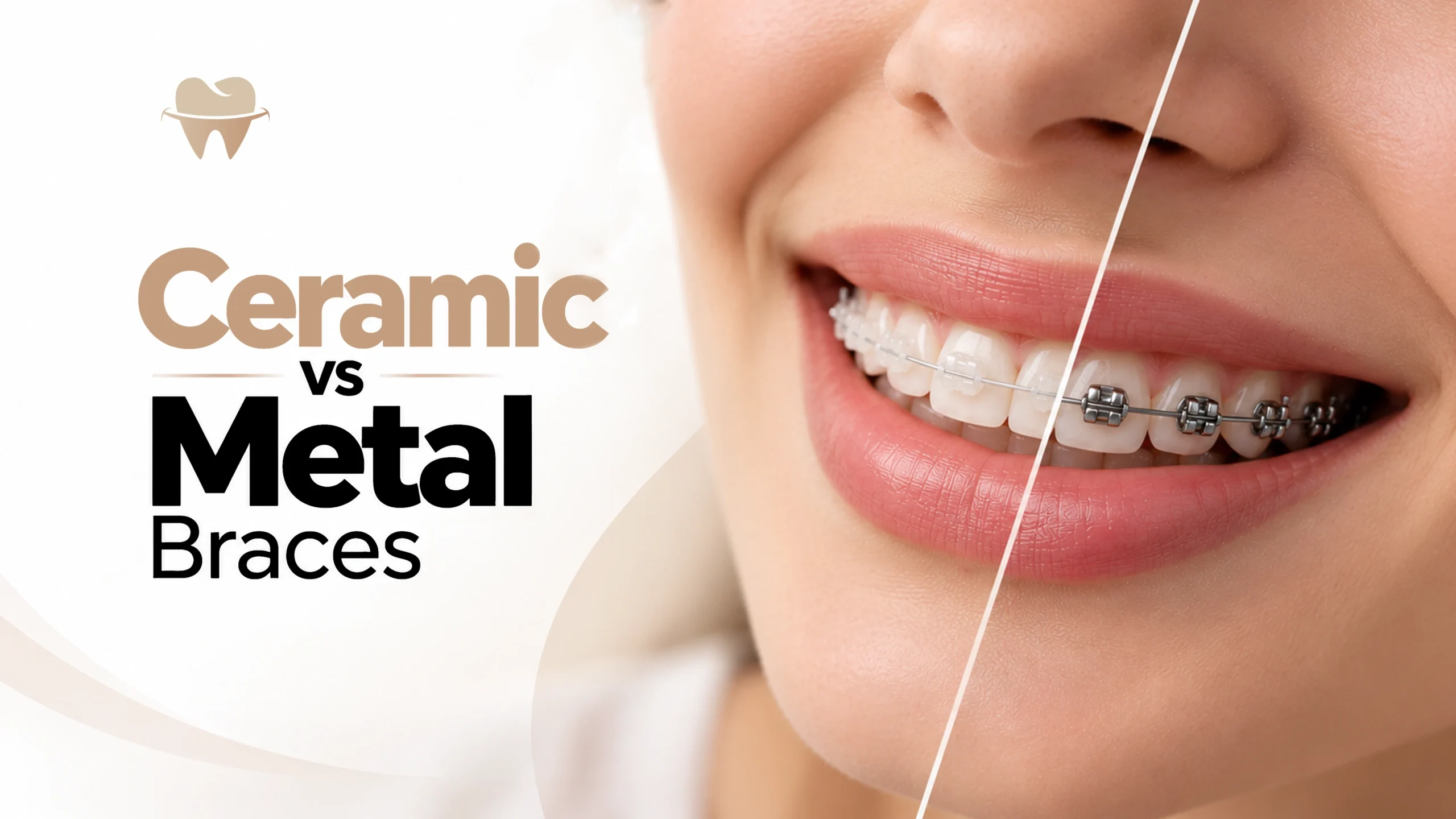 Ceramic vs Metal Braces