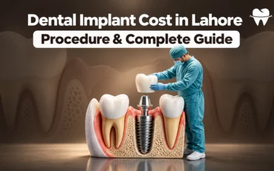 Dental Implant Cost in Lahore: Procedure & Complete Guide