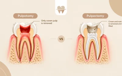 Pulpotomy vs Pulpectomy in Children: Which Treatment Is Better?