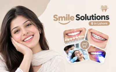 Best Smile Solutions in Lahore: Treatments, Options and Costs