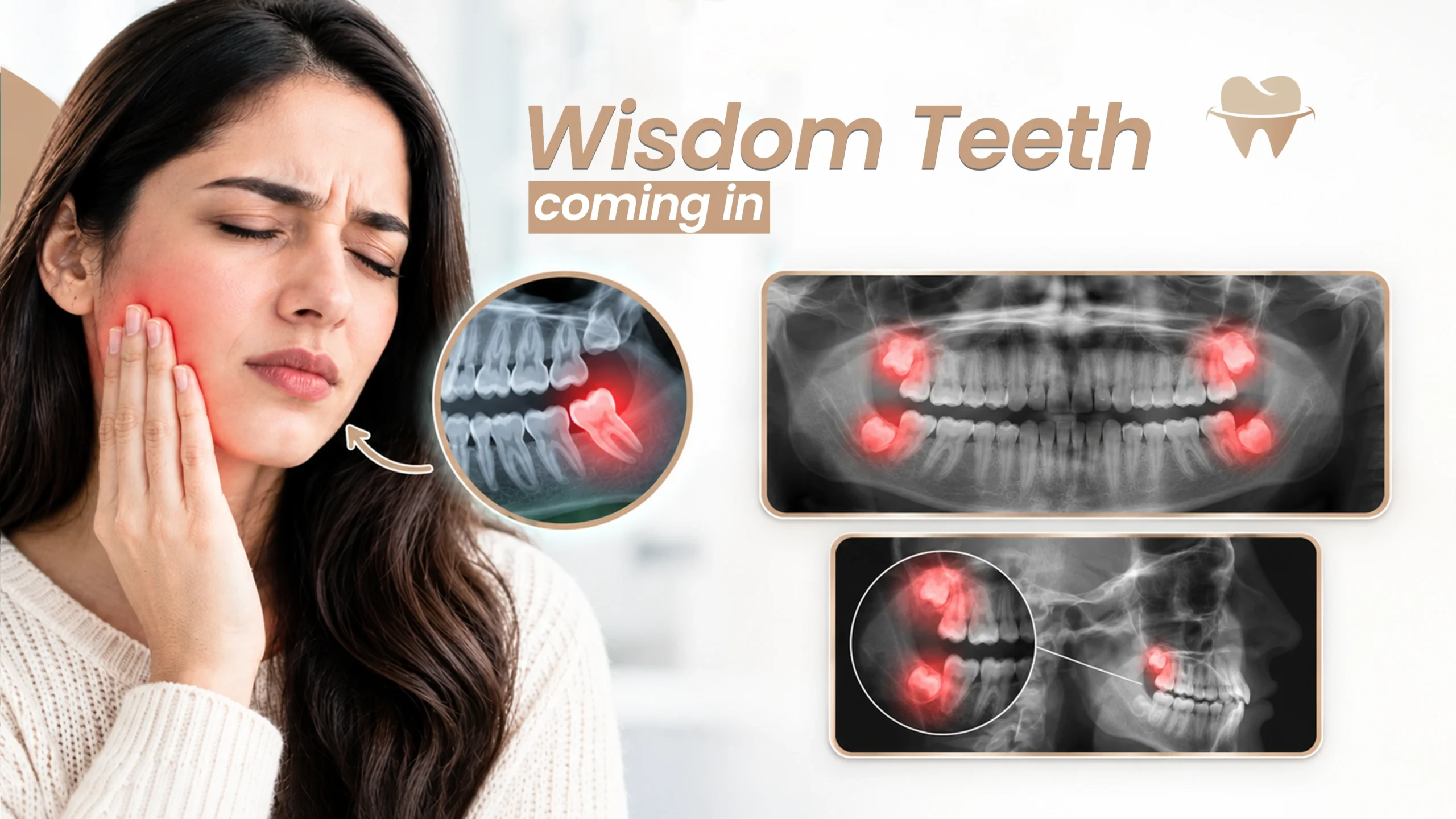 Early Signs of Wisdom Teeth Coming In Early Signs of Wisdom Teeth Coming In